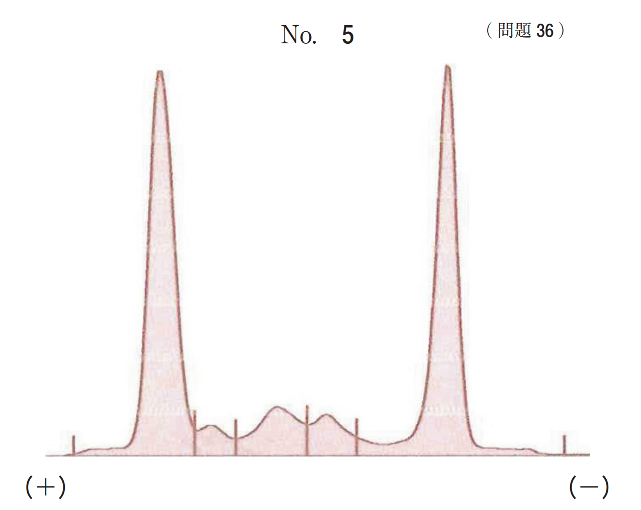 蛋白分画パターンまとめ ゴロ寝塾
